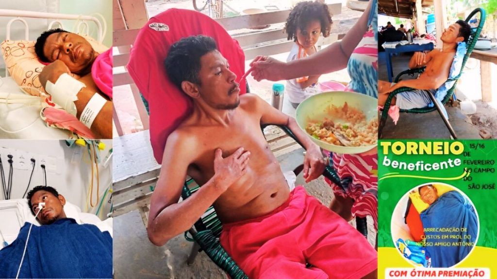 “Torneio Beneficente” em prol de Antônio, que enfrenta coágulo de sangue na cabeça